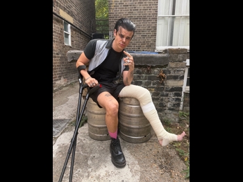  alt="Yungblud"