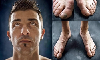 David Villa