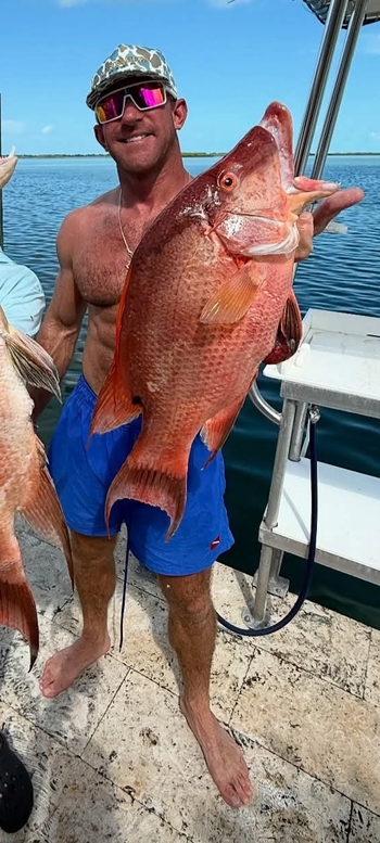 Pete Hunziker