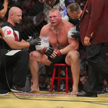 Brock Lesnar