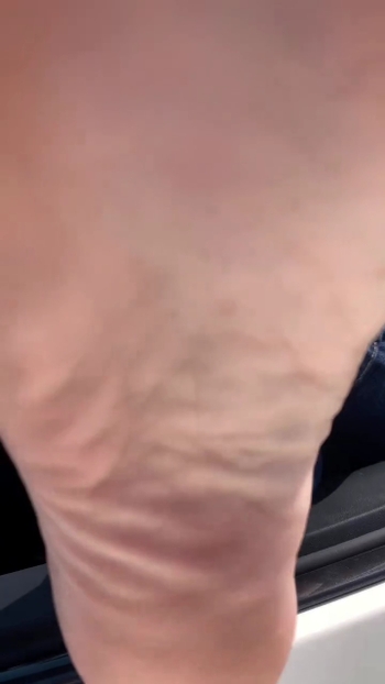 Kyle Unfug