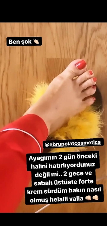 Ebru Polat