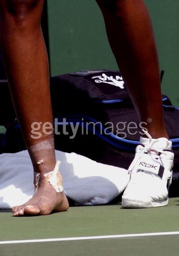 Venus Williams