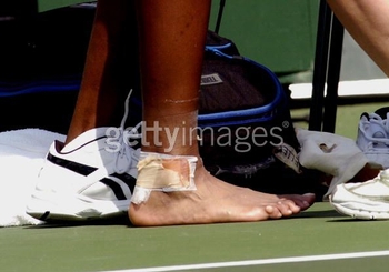 Venus Williams