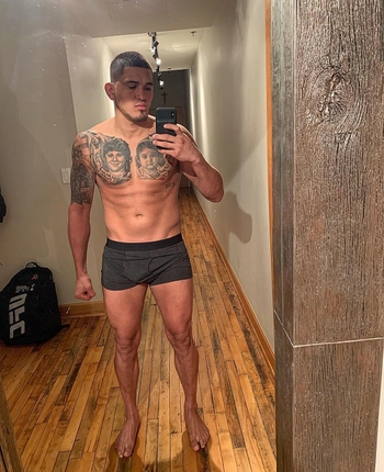 Anthony Pettis