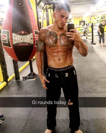 Anthony Pettis