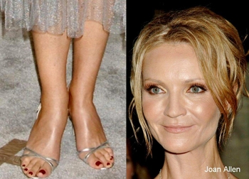 Joan Allen (I)