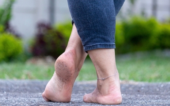 Anna Dreamfeet
