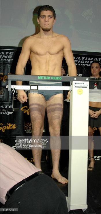 Nick Diaz