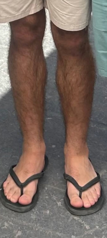 Andrés Vázquez