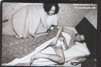 Brett Anderson