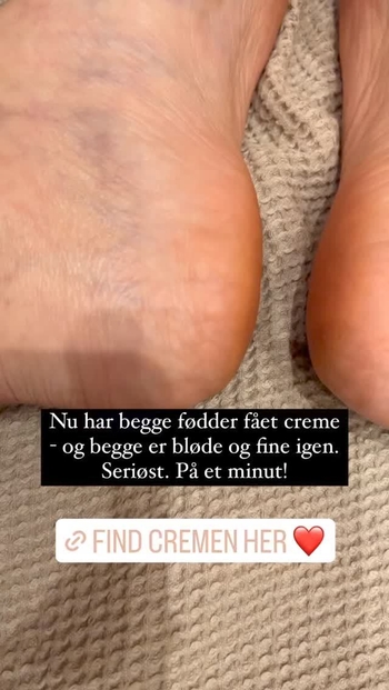 Cana Buttenschøn